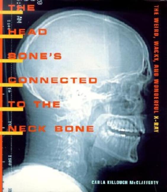 The Head Bone’s Connected to the Neck Bone:  The Weird, Wacky, and Wonderful X-ray 